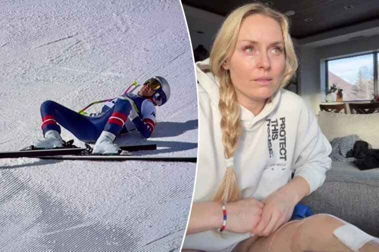 lindsey-vonn-reveals-how-close-she-was-to-getting-her-leg-amputated-after-frightening-olympics-crash