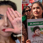 iranian-woman-who-lost-her-eye-after-being-shot-by-the-revolutionary-guard-slams-kamala-harris’-response-to-the-bombing