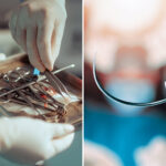 the-shocking-items-doctors-leave-in-patients-after-surgery