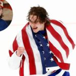 jack-hughes-reveals-plan-to-get-famous-olympic-teeth-fixed-as-he-worries-fans-will-be-‘pissed’