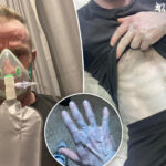 man-hospitalized-after-turning-blue-from-head-to-toe-—-leading-to-bizarre-bedroom-discovery