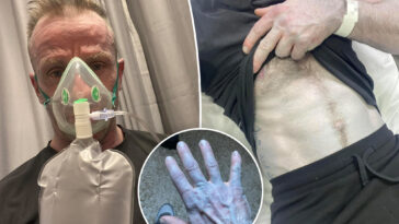 man-hospitalized-after-turning-blue-from-head-to-toe-—-leading-to-bizarre-bedroom-discovery