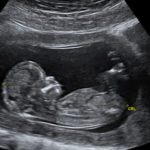 abortion-providers-don’t-deserve-our-appreciation