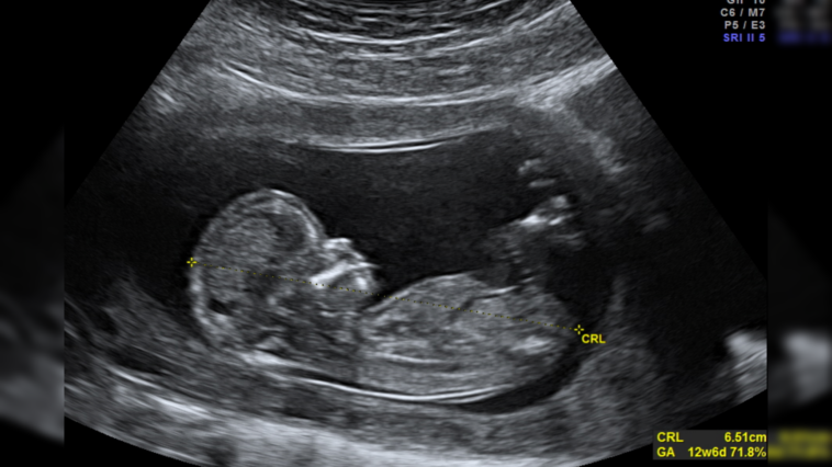 abortion-providers-don’t-deserve-our-appreciation