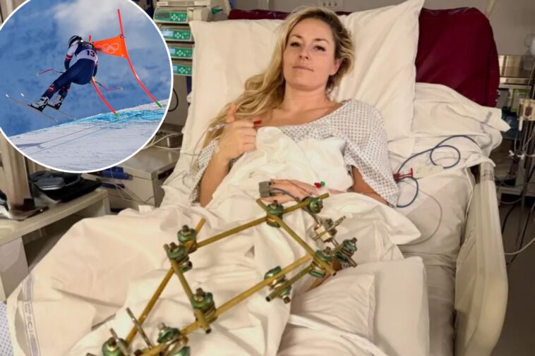lindsey-vonn-fires-back-at-retirement-talk-after-dad’s-plea-following-horrific-olympics-injury
