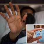 first-known-case-of-severe-mpox-virus-strain-detected-in-nyc