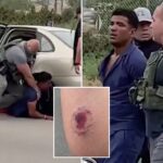 vile-photo-shows-gruesome-bite-mark-on-ice-officer-after-alleged-tren-de-aragua-gangster-attacked-him