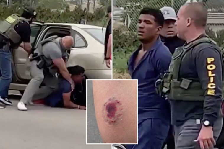 vile-photo-shows-gruesome-bite-mark-on-ice-officer-after-alleged-tren-de-aragua-gangster-attacked-him