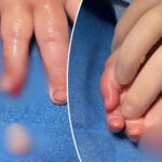 baby’s-finger-allegedly-severed-at-day-care-center