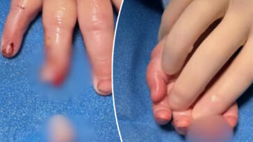 baby’s-finger-allegedly-severed-at-day-care-center