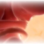 dark-day:-british-house-of-lords-approves-up-to-birth-abortions-to-become-law,-as-the-culture-of-death-takes-over-the-uk