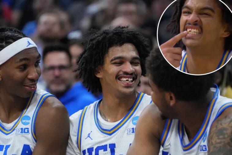 ucla’s-skyy-clark-gets-part-of-tooth-knocked-out-in-wild-march-madness-moment