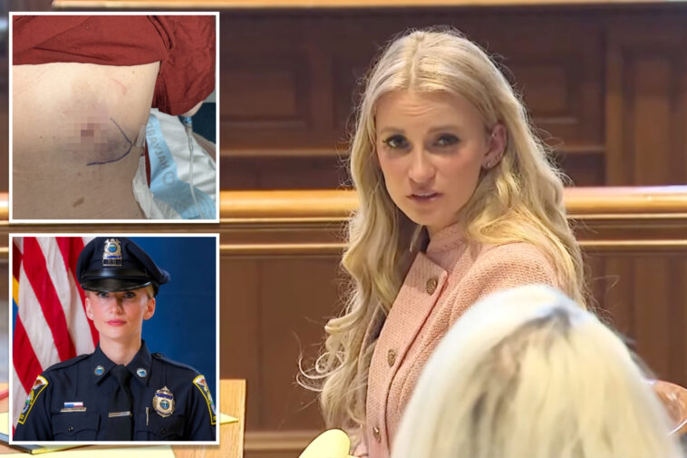 cop-kelsey-fitzsimmons-shares-graphic-image-of-where-she-was-shot-by-fellow-officer-as-she-plans-lawsuit-against-town