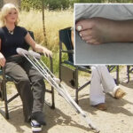 socal-girl,-14,-reveals-horrific-injuries-after-rattlesnake-nearly-killed-her:-‘my-hearing-went-out’