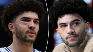 cameron-boozer-suffered-multiple-facial-fractures-in-duke’s-elight-eight-loss-to-uconn