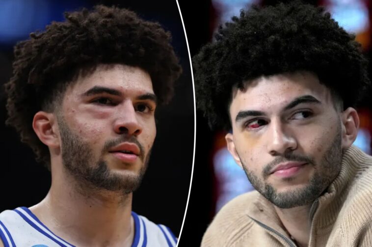 cameron-boozer-suffered-multiple-facial-fractures-in-duke’s-elight-eight-loss-to-uconn