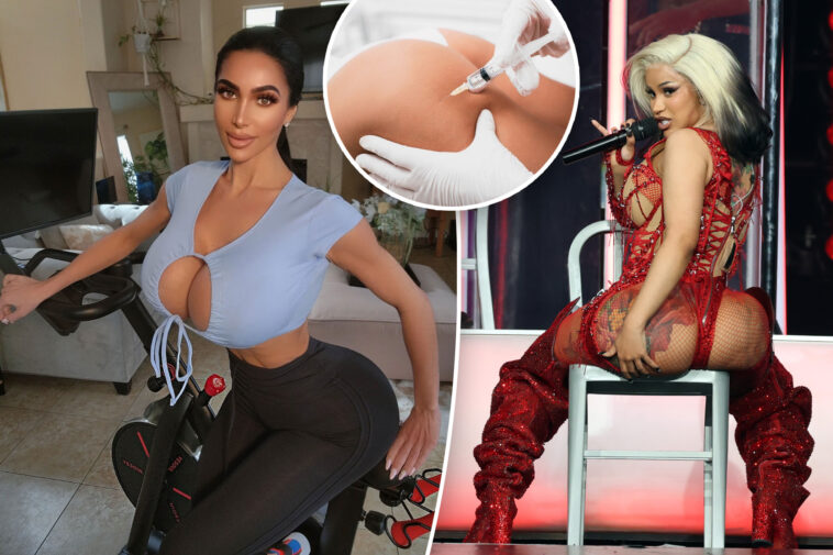 model-dies-from-illegal-‘liquid-bbl’-—-what-to-know-about-the-risky-procedure-that-left-cardi-b-in-the-‘craziest-pain-ever’