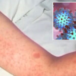 world’s-most-contagious-disease-continues-to-spread-in-california-as-more-clusters-form