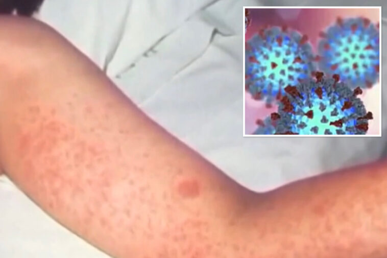 world’s-most-contagious-disease-continues-to-spread-in-california-as-more-clusters-form