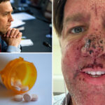 ex-sen.-ben-sasse-on-the-‘nasty-drug’-for-stage-4-cancer-that-makes-him-‘bleed-out-of-a-whole-bunch-of-parts’