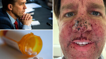 ex-sen.-ben-sasse-on-the-‘nasty-drug’-for-stage-4-cancer-that-makes-him-‘bleed-out-of-a-whole-bunch-of-parts’