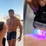 what-is-butt-microneedling?-behind-the-‘desperate’-procedure-kelly-ripa-tried