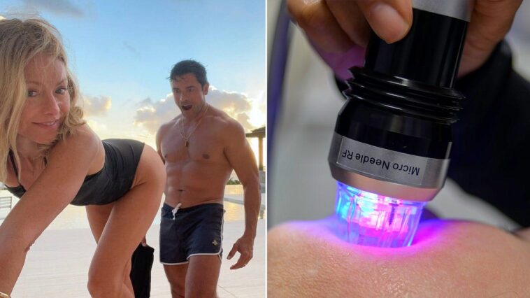 what-is-butt-microneedling?-behind-the-‘desperate’-procedure-kelly-ripa-tried