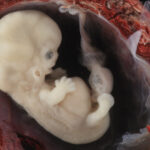 one-third-of-my-generation-aborted-—-america’s-birth-rate-collapsing-as-the-left-destroys-the-family