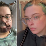 illinois-mom-gets-face-ripped-apart-by-rescue-dog-after-suffering-seizure