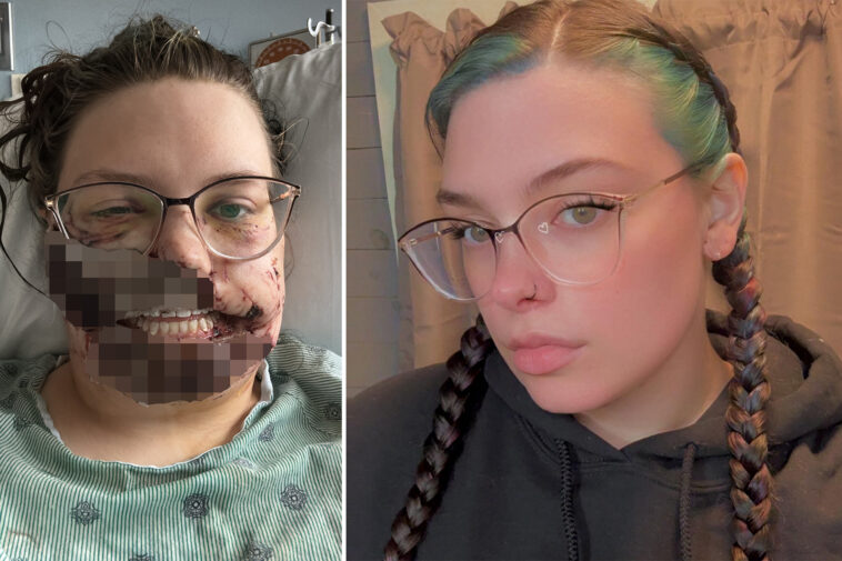 illinois-mom-gets-face-ripped-apart-by-rescue-dog-after-suffering-seizure