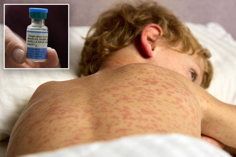 outbreak-of-world’s-most-contagious-disease-in-california-hits-highest-levels-in-nearly-a-decade