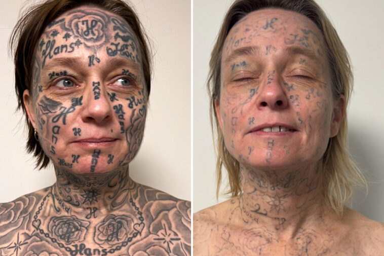 evil-abuser-tattooed-his-name-250-times-across-girlfriend’s-face,-body-with-cheap-online-machine