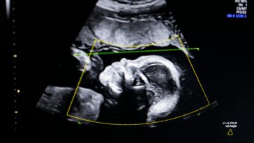 the-history-behind-this-abortion-law-reveals-who-it-was-built-to-target