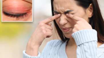 ai-chatbots-fall-for-fake-diseases-and-phony-studies-—-as-experts-warn-against-taking-tips-from-bots