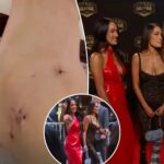 nikki-bella-shows-photo-of-gruesome-ankle-injury-that-caused-her-to-miss-wrestlemania-match