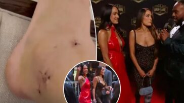 nikki-bella-shows-photo-of-gruesome-ankle-injury-that-caused-her-to-miss-wrestlemania-match