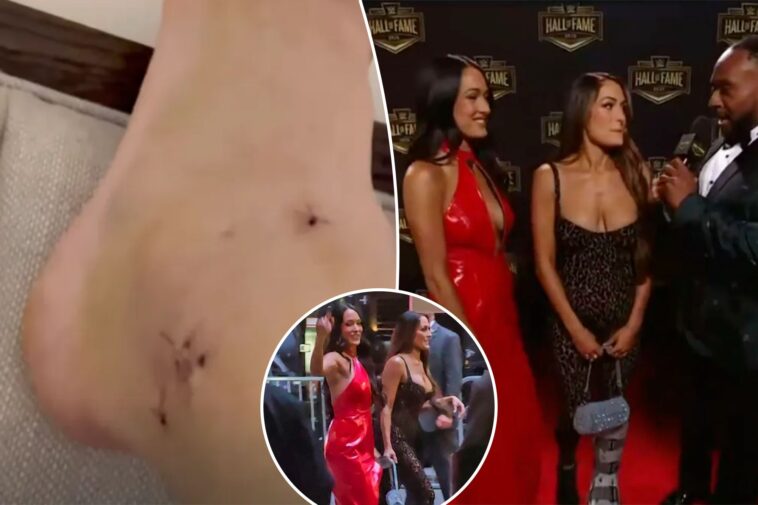 nikki-bella-shows-photo-of-gruesome-ankle-injury-that-caused-her-to-miss-wrestlemania-match