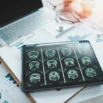 what-researchers-just-pulled-off-could-change-memory-loss-as-we-know-it