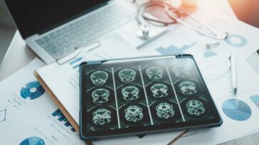 what-researchers-just-pulled-off-could-change-memory-loss-as-we-know-it