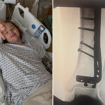 bluegrass-artist-billy-strings-breaks-leg-while-skateboarding-at-his-virginia-concert:-‘feel-like-such-an-idiot’