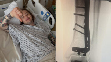 bluegrass-artist-billy-strings-breaks-leg-while-skateboarding-at-his-virginia-concert:-‘feel-like-such-an-idiot’