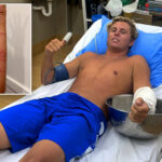australian-surfer-miraculously-survives-attack-from-‘world’s-most-venomous-animal’