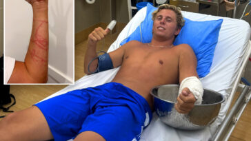australian-surfer-miraculously-survives-attack-from-‘world’s-most-venomous-animal’