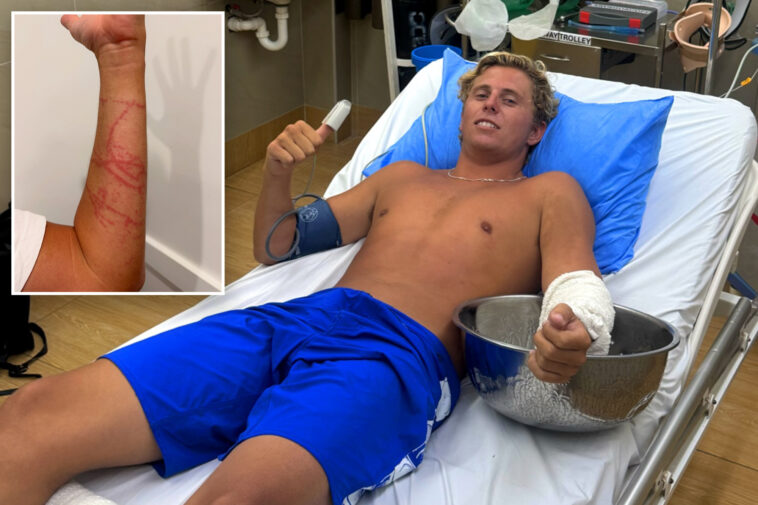 australian-surfer-miraculously-survives-attack-from-‘world’s-most-venomous-animal’