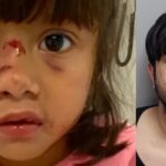 biden-admin-let-illegal-alien-cannibal-stay-in-us.-after-previous-felony-assault-deemed-‘not-egregious-enough,’-now-he-tried-to-eat-three-year-old-girl’s-face-in-texas-park