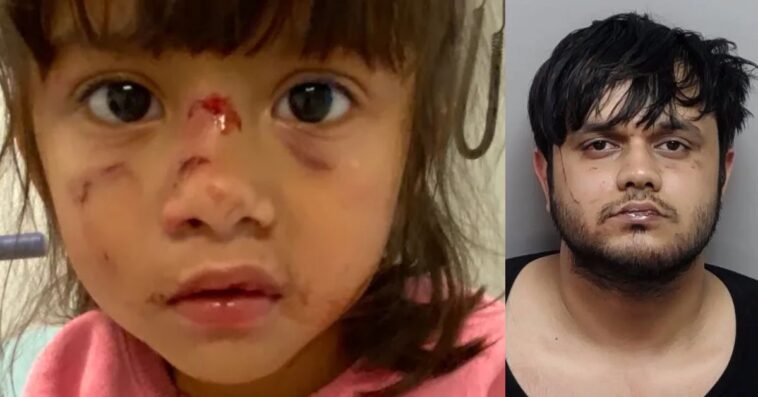 biden-admin-let-illegal-alien-cannibal-stay-in-us.-after-previous-felony-assault-deemed-‘not-egregious-enough,’-now-he-tried-to-eat-three-year-old-girl’s-face-in-texas-park