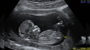 woman-stuns-crowd-at-far-left-uc-berkeley-with-powerful-prolife-message-(video)