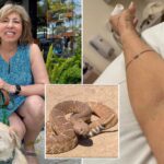 grisly-pictures-show-aftermath-of-rattlesnake-bite-—-as-victim-speaks-out