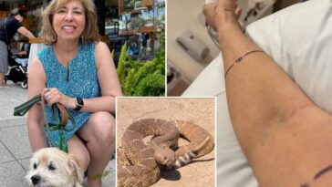 grisly-pictures-show-aftermath-of-rattlesnake-bite-—-as-victim-speaks-out