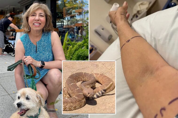 grisly-pictures-show-aftermath-of-rattlesnake-bite-—-as-victim-speaks-out